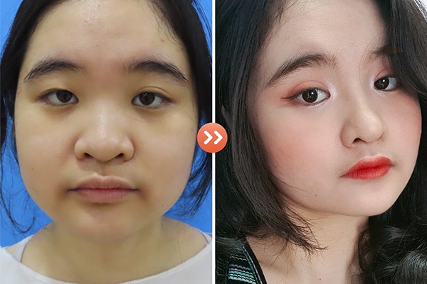 đối tượng xăm môi