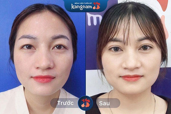 khách hàng review dịch vụ kangnam