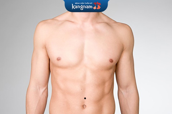 mụn ruồi trên rốn nam