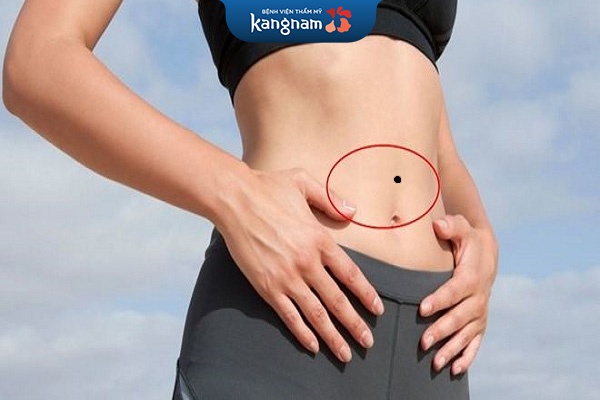 nốt ruồi phía trên rốn