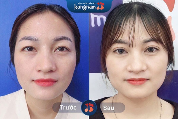 phun lông mày tại kangnam