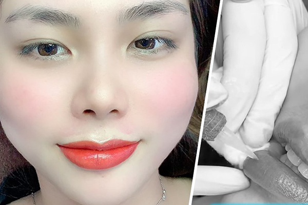 Sau sinh bao lâu thì được phun môi