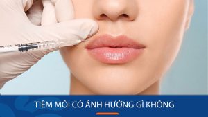 Tiêm môi có ảnh hưởng gì không? Giải mã tác động và lưu ý quan trọng