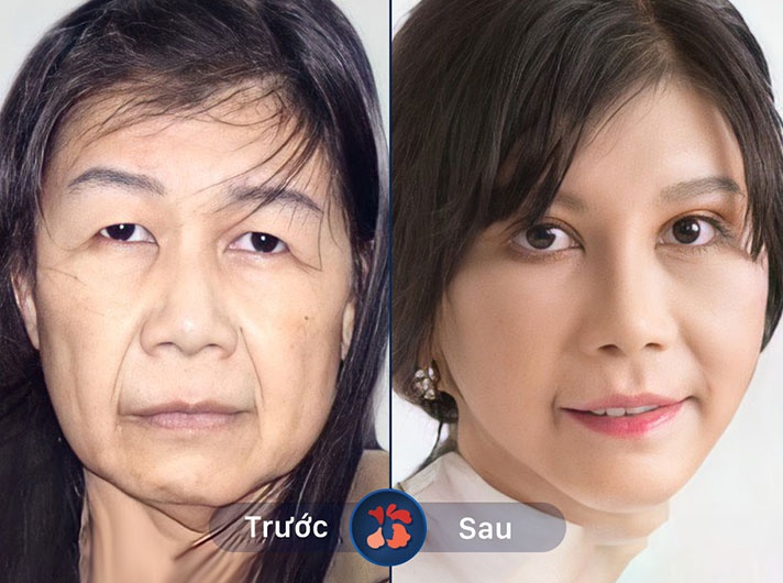 ALBUM KHÁCH HÀNG TRẺ HÓA DA