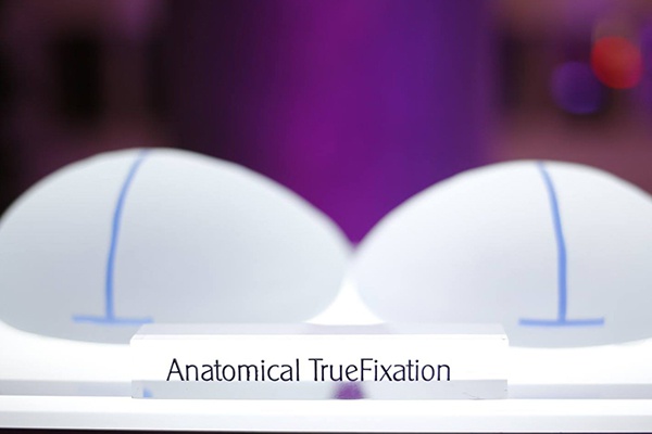 túi độn Anatomical TrueFixation