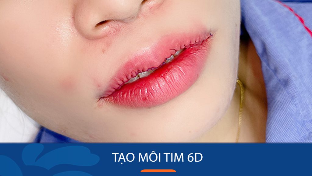 Tạo môi tim 6D không dấu vết: Bí quyết sở hữu đôi môi quyến rũ tự nhiên