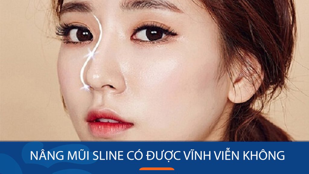 Nâng mũi S-line có vĩnh viễn không? Thời gian duy trì & yếu tố ảnh hưởng