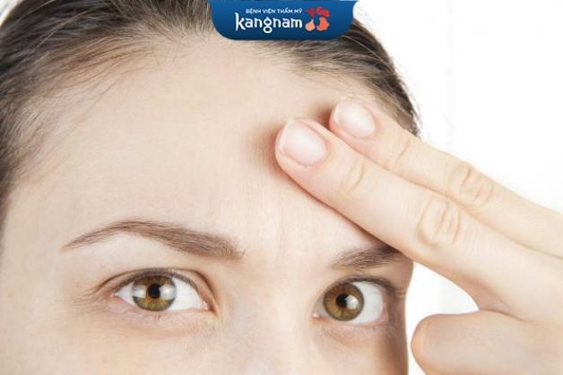 Có nên cấy tóc cho trán cao