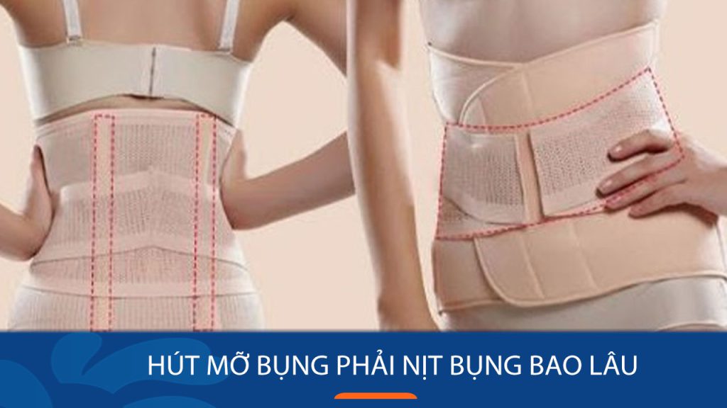 Hút mỡ bụng phải nịt bụng bao lâu? Hướng dẫn nịt bụng đúng cách sau giảm mỡ