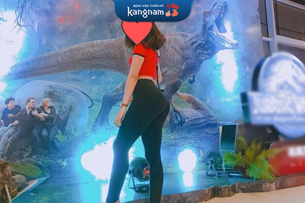 Chị Hạnh đánh giá ảnh hưởng sau nâng mông