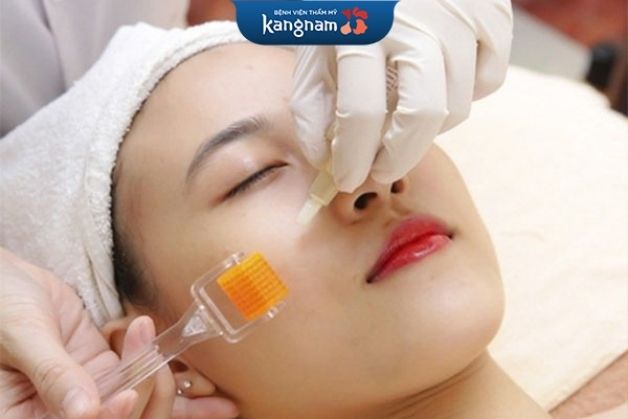 Lăn kim trị sẹo