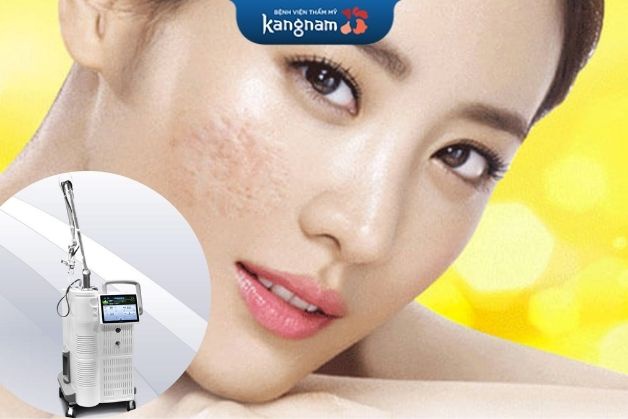 Laser không phân tách giảm sẹo rỗ