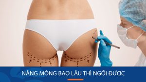 Nâng mông bao lâu thì ngồi được? Những yếu tố ảnh hưởng