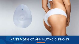 Nâng mông có ảnh hưởng gì không? có nguy hiểm không