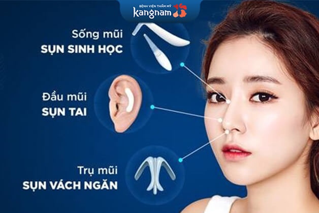Nâng mũi cấu trúc có bị lệch không