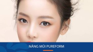 Nâng mũi Pureform là gì? Ưu điểm, đối tượng phù hợp và so sánh các phương pháp