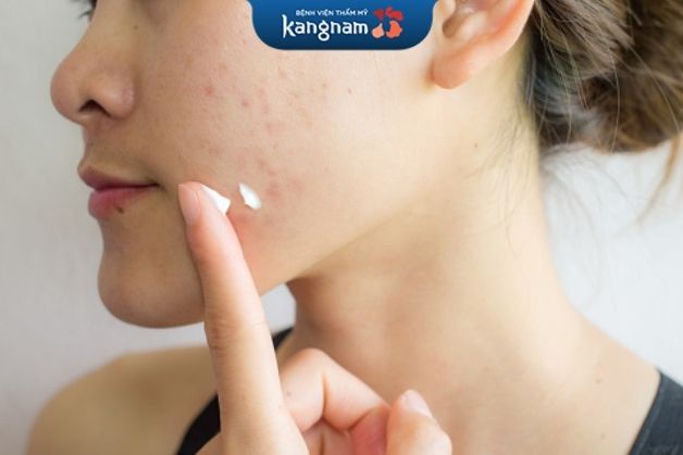 Kem đặc trị giúp xóa sẹo và cải thiện những vùng da tối màu