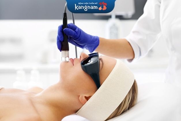 Công nghệ trị sẹo thâm cho bà đầu bằng Laser