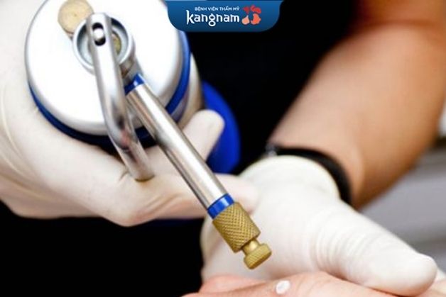 Áp lạnh chữa sẹo