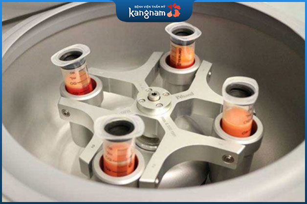 Chiết xuất và xử lý tế bào gốc trước khi cấy lên mặt