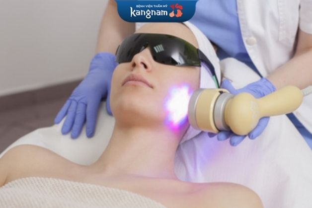 Điều trị sẹo bằng laser