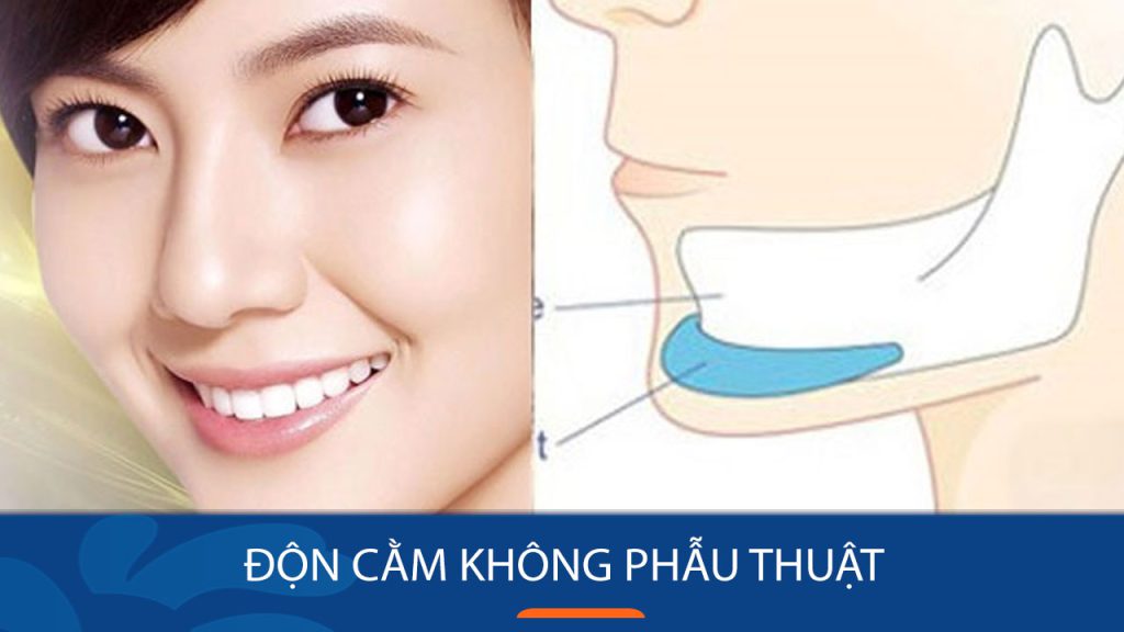 Độn cằm không phẫu thuật là gì? Hiệu quả, độ an toàn và ai phù hợp