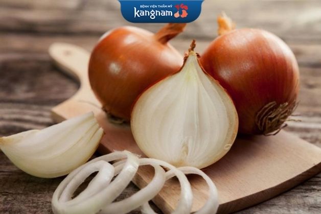 Hành tây trị sẹo xấu