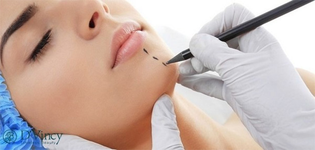 Ưu điểm của phương pháp độn cằm không để lại sẹo