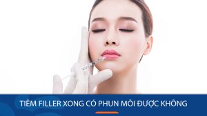 Tiêm Filler xong có phun môi được không?Bí quyết sở hữu đôi môi hoàn hảo