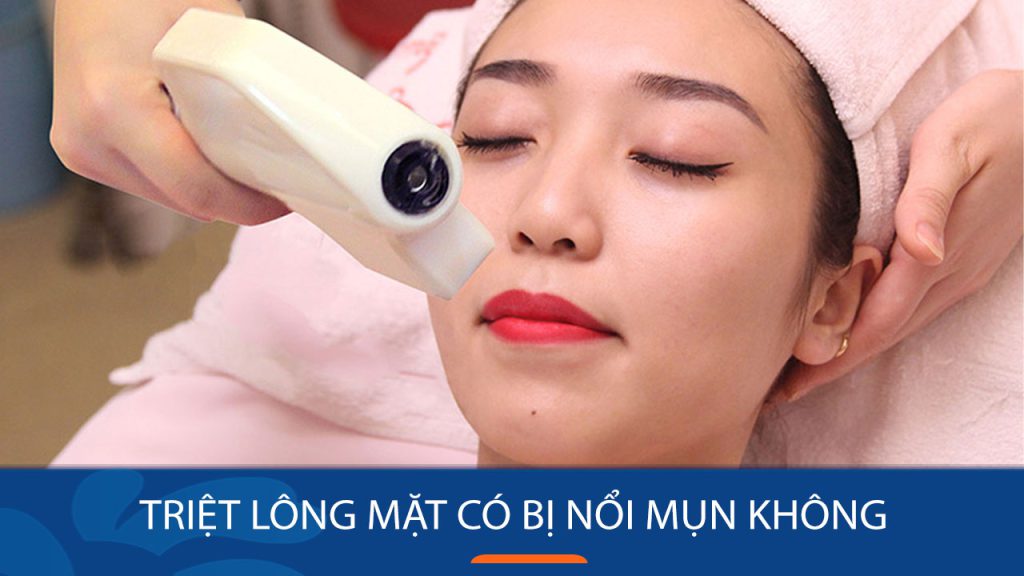 Triệt lông mặt có bị nổi mụn không? Giải đáp từ chuyên gia da liễu