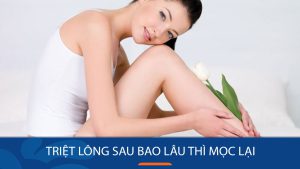 Triệt Lông Vĩnh Viễn Sau Bao Lâu Lông Mọc Lại? Bí Quyết Giữ Da Mịn Màng