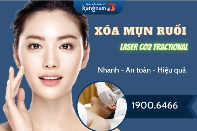 Tẩy nốt ruồi an toàn tại Kangnam