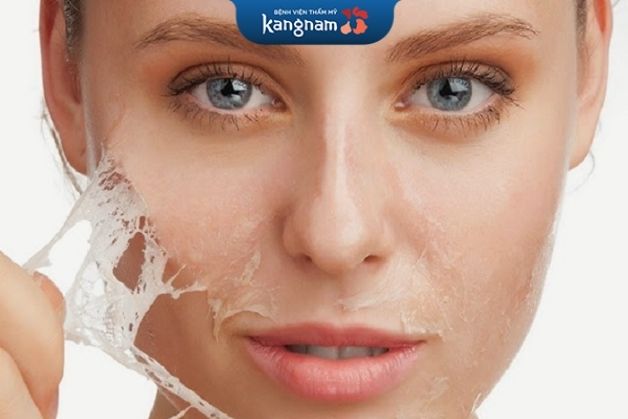 Để da tự bong sau khi bắn tia laser