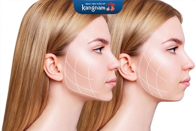 Phẫu thuật hàm cần 3-6 tháng để hồi phục hoàn toàn