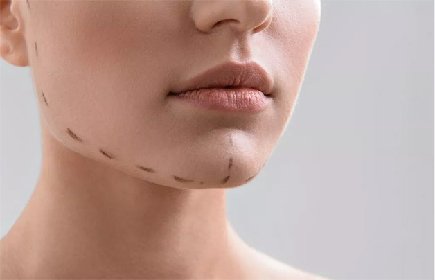 Ngày nay, phẫu thuật hàm hô đã không còn gây ra đau đớn