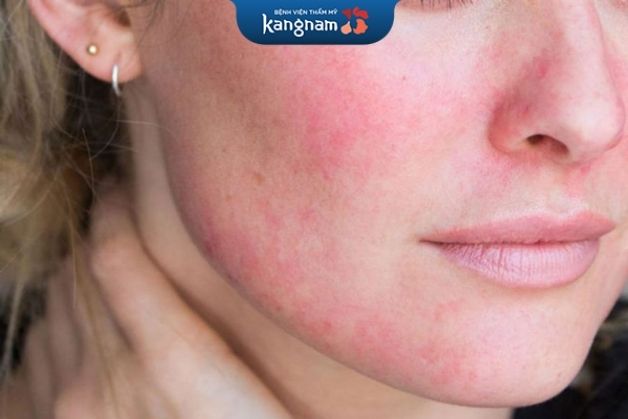 Sau khi bắn laser, da có thể mẩn đỏ và ngứa