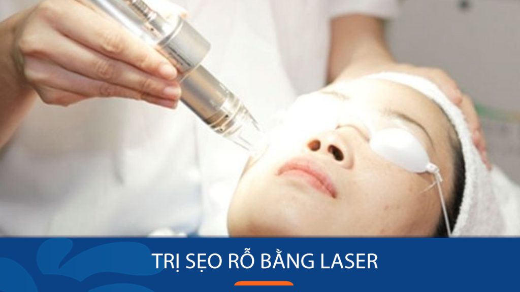 Trị sẹo rỗ bằng laser – trị sẹo rỗ tận gốc bằng laser an toàn, không xâm lấn