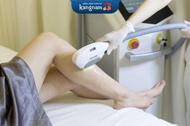 Triệt lông Diode Laser an toàn tại Kangnam