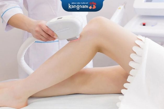 Triệt lông có thể giữ được từ 6 tháng đến nhiều năm tùy theo công nghệ áp dụng