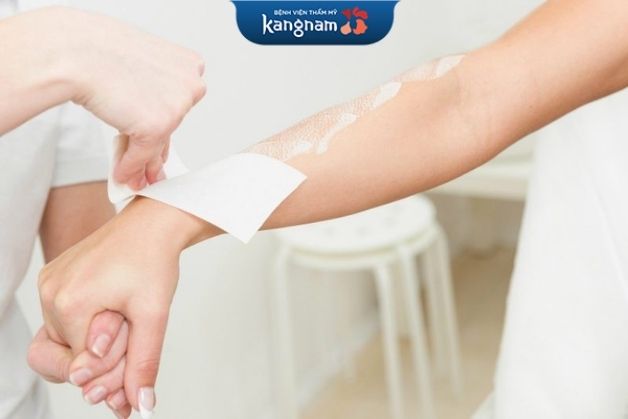 Triệt lông tay có tốt không?