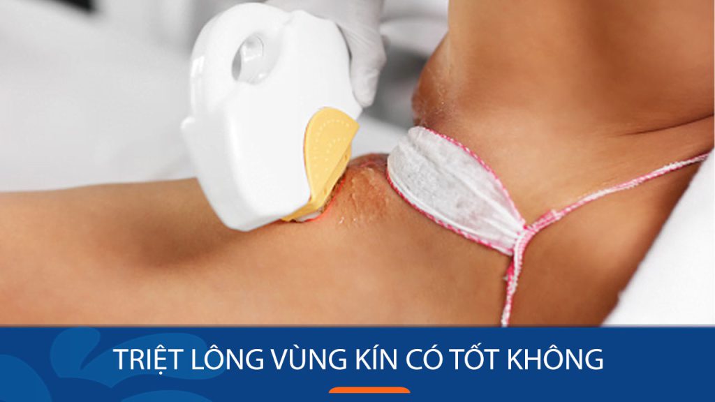 Bí Quyết Triệt Lông Vùng Kín Tận Gốc, Mịn Màng Không Tì Vết