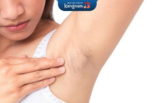 Triệt lông rồi có mọc lại không