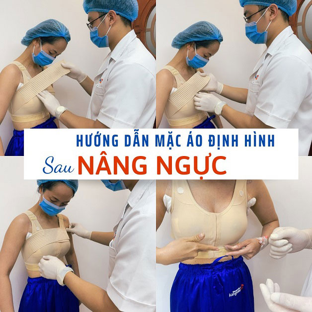 Chú ý chăm sóc ngực cẩn thận sau nâng