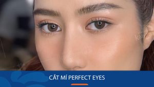 Cắt mí Perfect Eyes là gì? Đối tượng phù hợp & điểm khác biệt