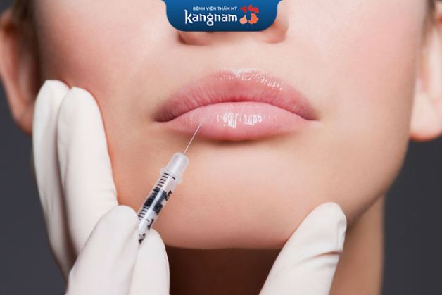 Cấy mỡ môi khắc phục môi mỏng