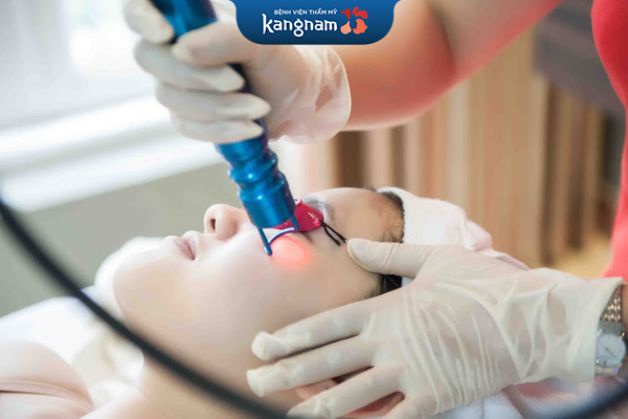 Trị mụn với tia laser dùng ánh sáng laser chiếu trực tiếp vào vùng da có mụn cần điều trị