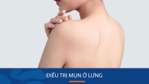 Điều trị mụn ở lưng: Bí quyết trị dứt mụn ở lưng tận gốc