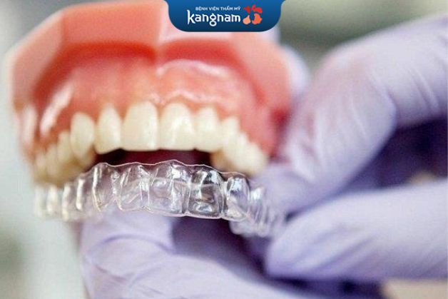 Khay niềng răng trong suốt có nhiều ưu điểm