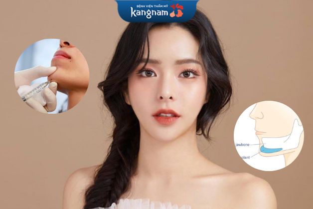 Lưu ý cần nhớ khi chỉnh cằm bằng 2 phương pháp