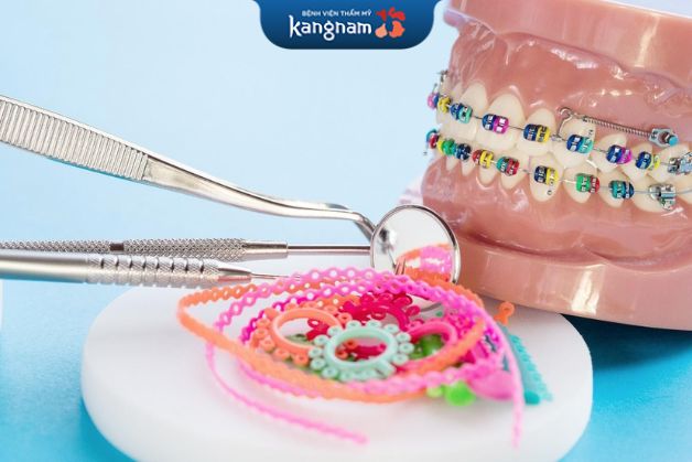 Mắc cài kim loại có nhiều kiểu bắt mắt